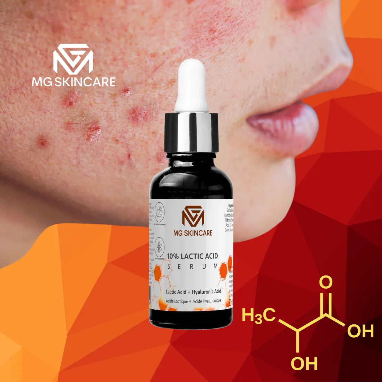 Lactic Acid Serum