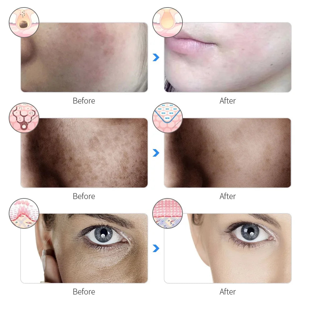 Rechargeable 7-Color LED Photon Face Mask