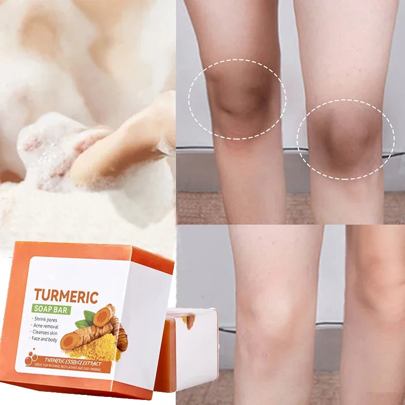 Handmade Turmeric Brightening Face & Body Soap