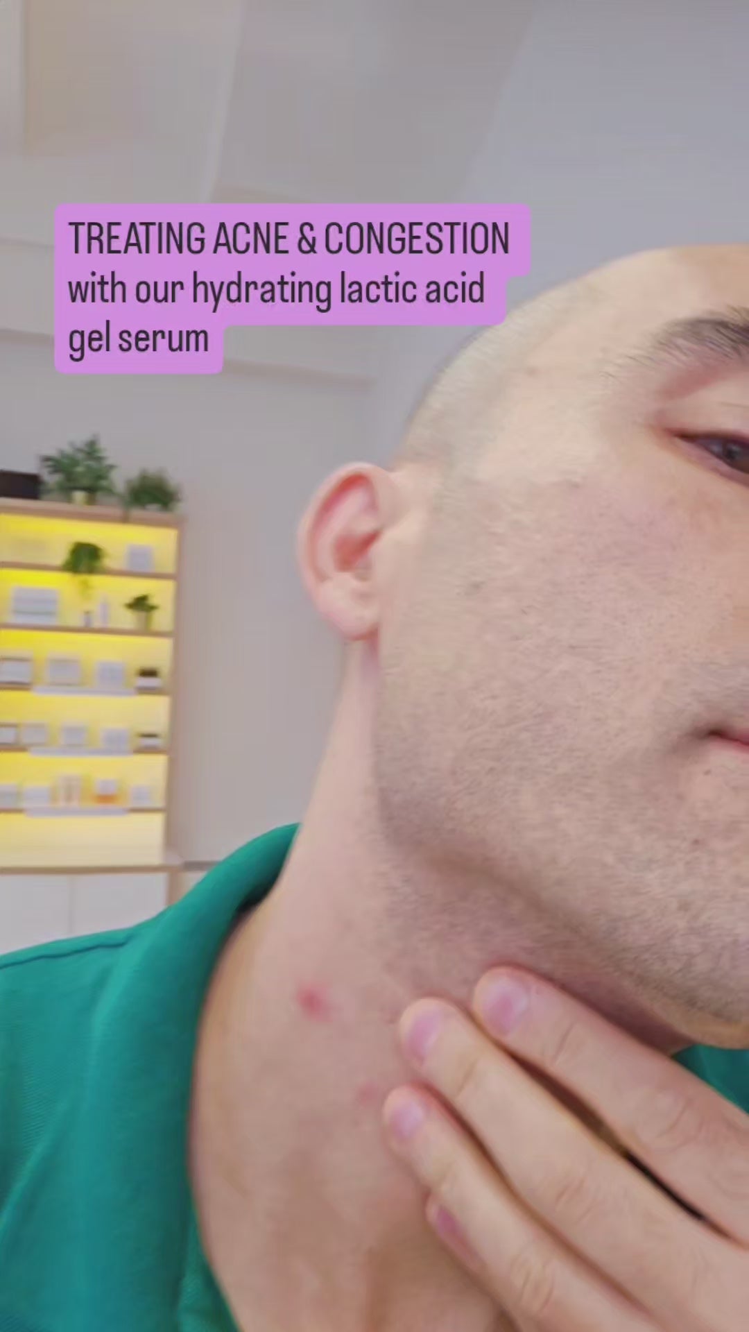 Lactic Acid Serum